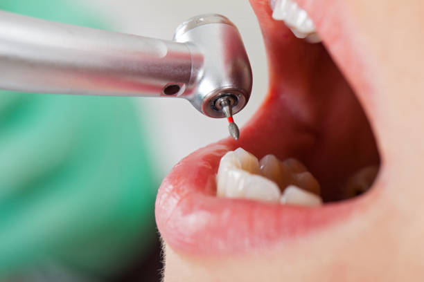 Best Emergency Gum Treatment in Oakland, IA